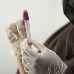 Bleeding disorders