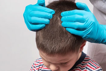 Overall scalp health