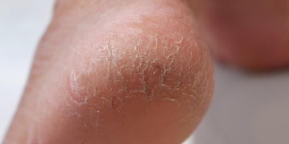 Supports Skin Repair